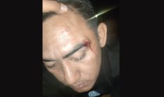 Kasus Pemukulan Warga Lenteng Sumenep Naik Sidik, Polisi Kantongi Bukti dan Hasil Visum